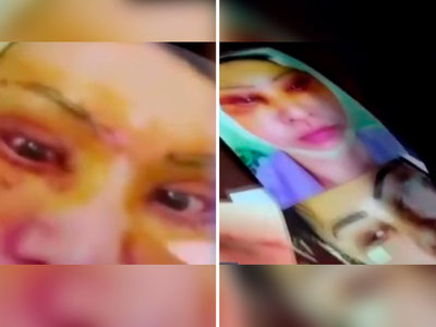 'Сохта косметологлар ер тўласида жарроҳлик қилган'ning rasmi