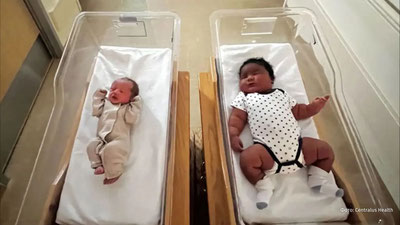 'АҚШда “гигант чақалоқ” дунёга келди'ning rasmi