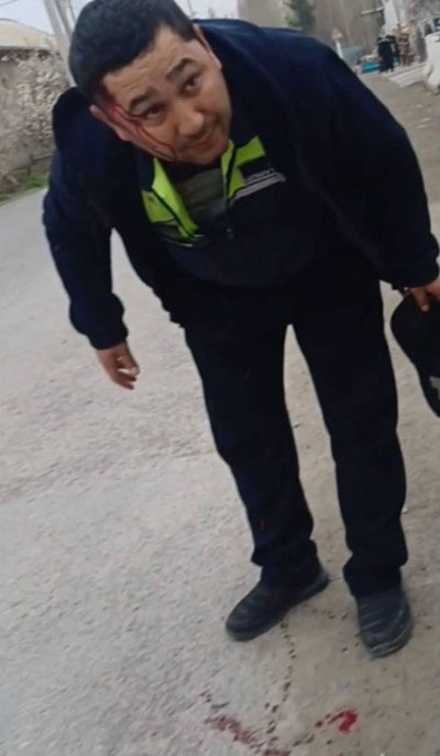 Изрображение 'В Ферганской области напали на сотрудника водоканала'