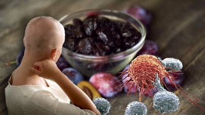 'Япониялик олимлар саратоннинг янги турини аниқлади'ning rasmi