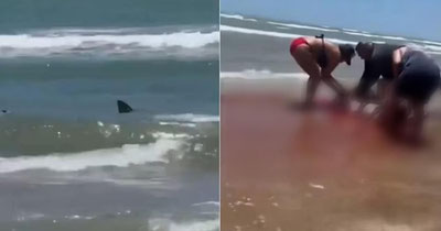 Image of 'In the Maldives, a tourist's foot was severed following a shark attack.'